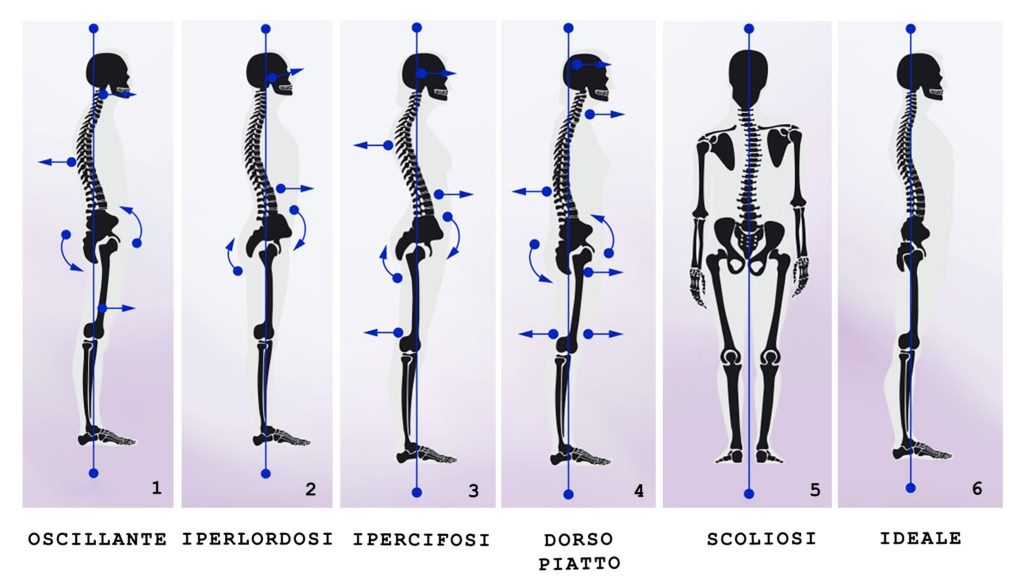 TIPOLOGIE-SI-POSTURA-bar